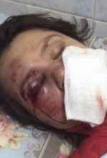 Генпрокуратура досі не знайшла винних у побитті журналістів