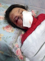 Затриманий п'ятий підозрюваний у справі про побиття Тетяни Черновол