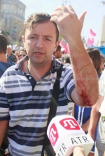 Побитий "Беркутом" "свободівець" потрапив на операційний стіл