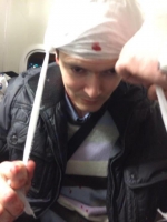 Беркут 2 години жорстоко бив активіста Євромайдану (+ ВІДЕО)